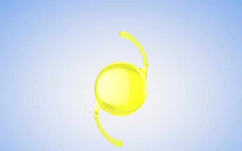 Tek odaklı (monofokal) lens görseli