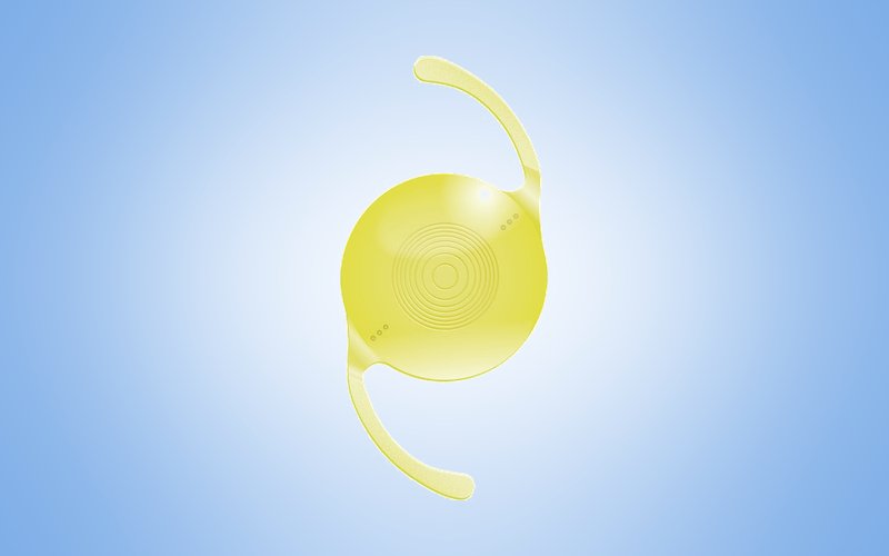 Trifokal (akıllı) lens görseli